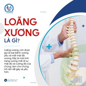 Loãng xương là gì?