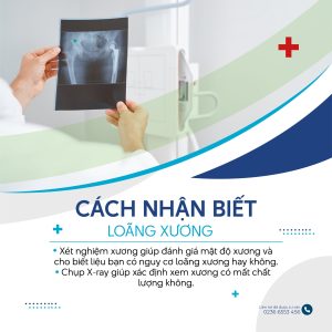 Cách nhận biết loãng xương