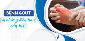 Bệnh Gout và những điều cần biết