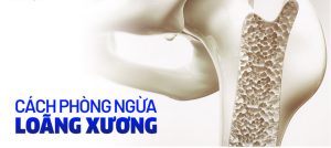 Một số cách phòng ngừa giúp ngăn chăn bệnh 